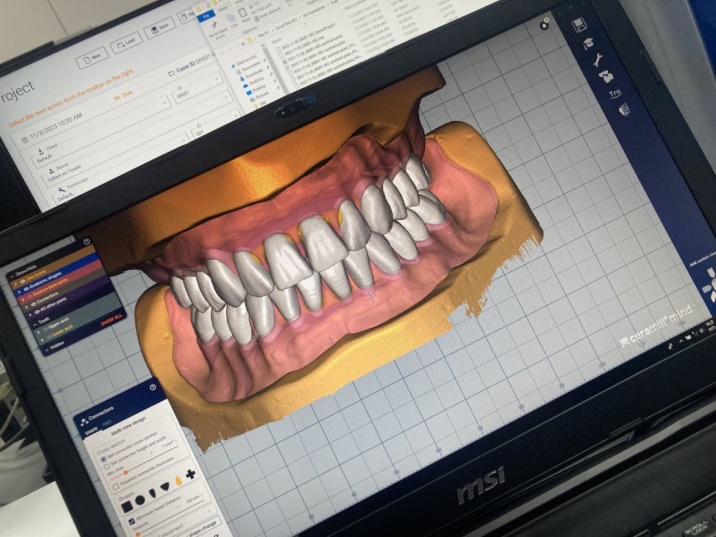 Digital Prosthetic Designer Opleiding