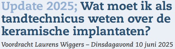 Voordracht Laurens Wiggers banner
