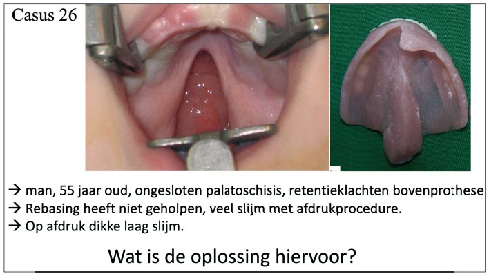 Casus Rico Koers KPT Klankbordgroep bijeenkomst